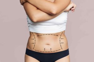 Full Body Liposuction Cost in Turkey