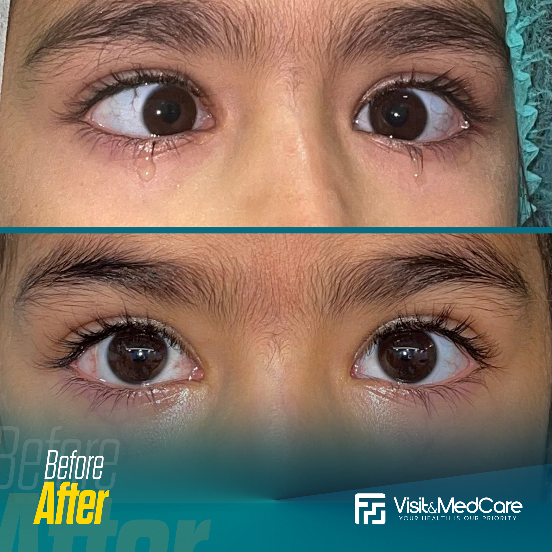Eye-Diseases-and-Vision-Correction1.png