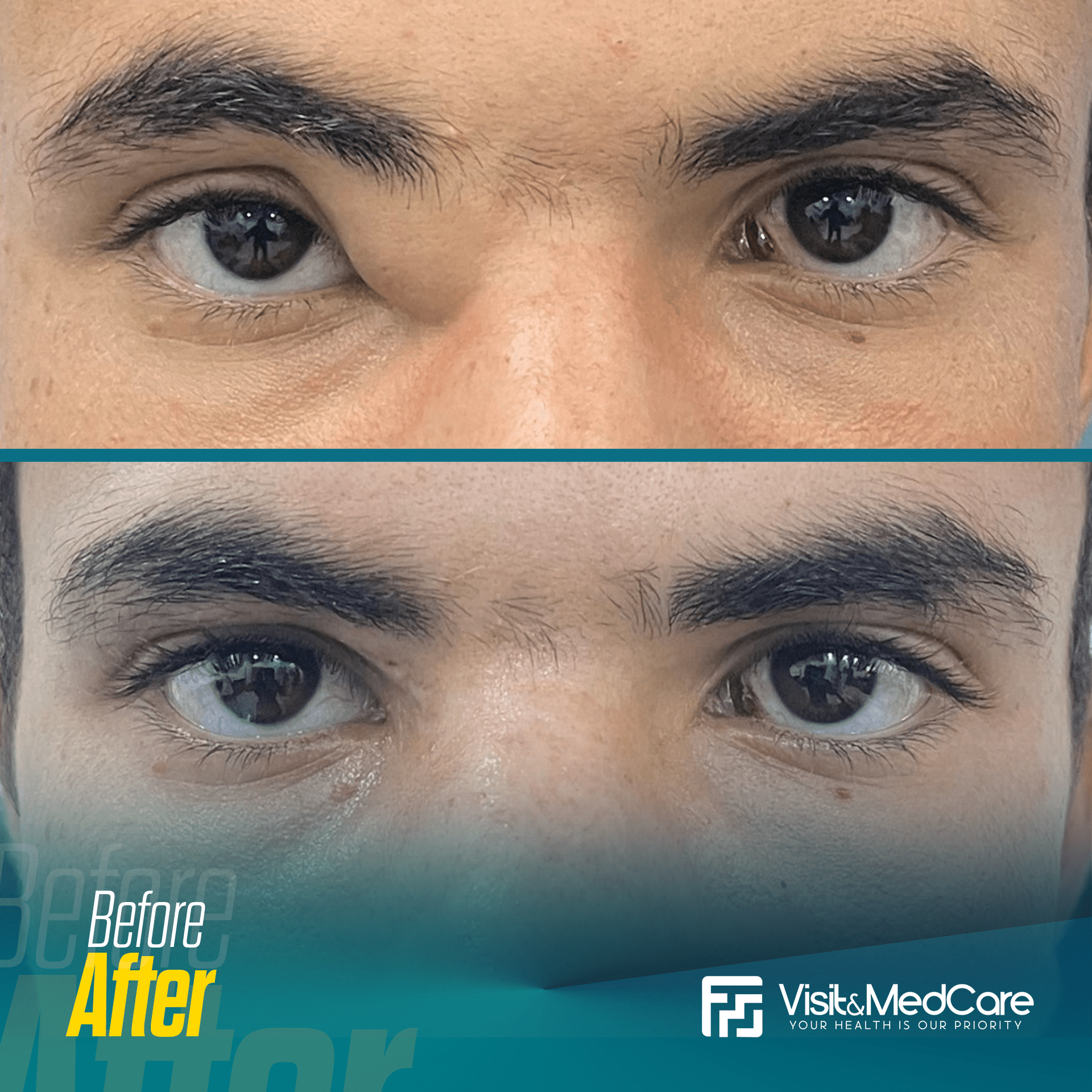 Eye-Diseases-and-Vision-Correction2.png