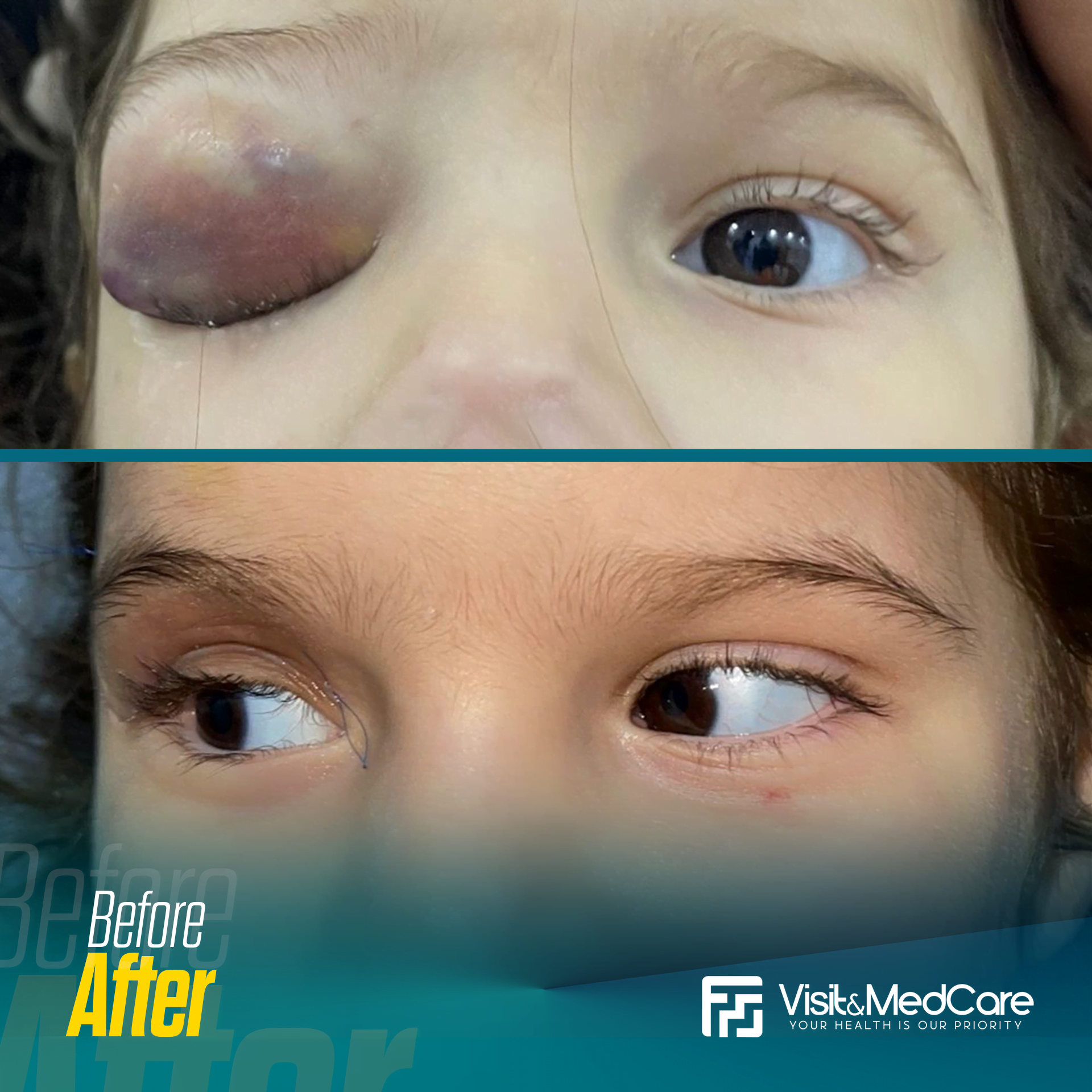 Eye-Diseases-and-Vision-Correction3.png
