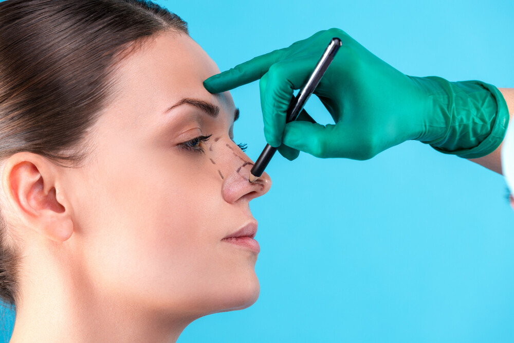 Proceso de rinoplastia