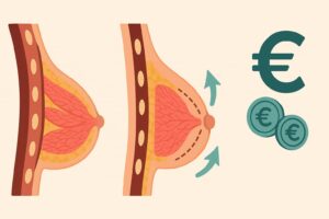 Aumento de senos por 2000 euros opciones, precios y clínicas recomendadas