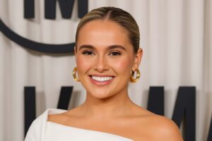 Molly-Mae Hague’s Smile Transformation Embracing Natural Beauty with Composite Bonding-min