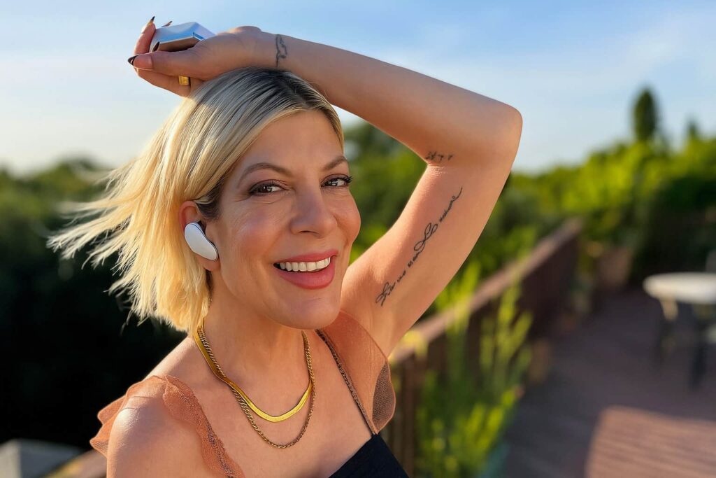 Tori Spelling’s Smile Makeover-min